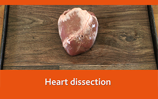 Heart dissection